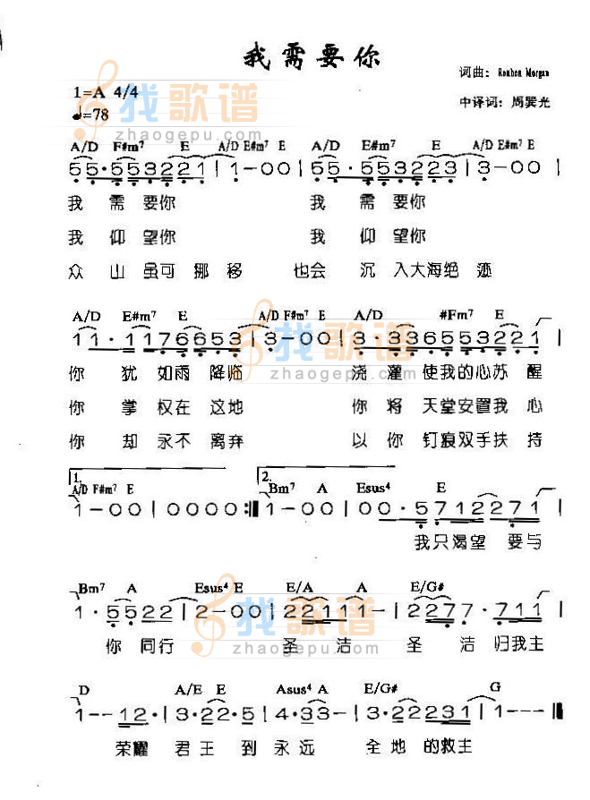 我需要你